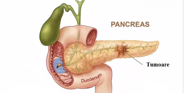 Pancreas