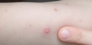 Află totul despre bolile copilăriei și ce trebuie să faci