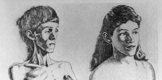 Cât de gravă este anorexia nervoasă și cum se poate trata