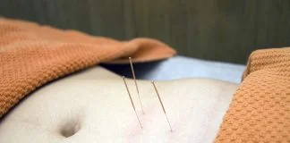 Ce afecțiuni ale organismului pot fi tratate cu succes prin acupunctură
