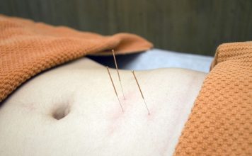Ce afecțiuni ale organismului pot fi tratate cu succes prin acupunctură