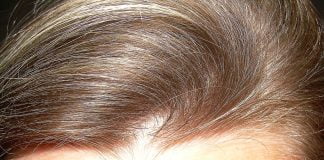 Cum poți trata ridurile eficient Cum poți trata ridurile eficient