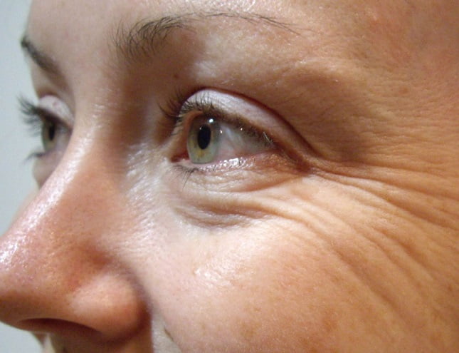 Cosmetice anti aging: combaterea ridurilor și întinerirea tenului | vasskids.ro