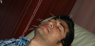 Vezi ce boli sunt tratabile prin acupunctură