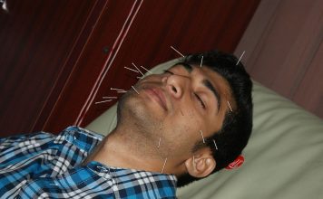 Vezi ce boli sunt tratabile prin acupunctură