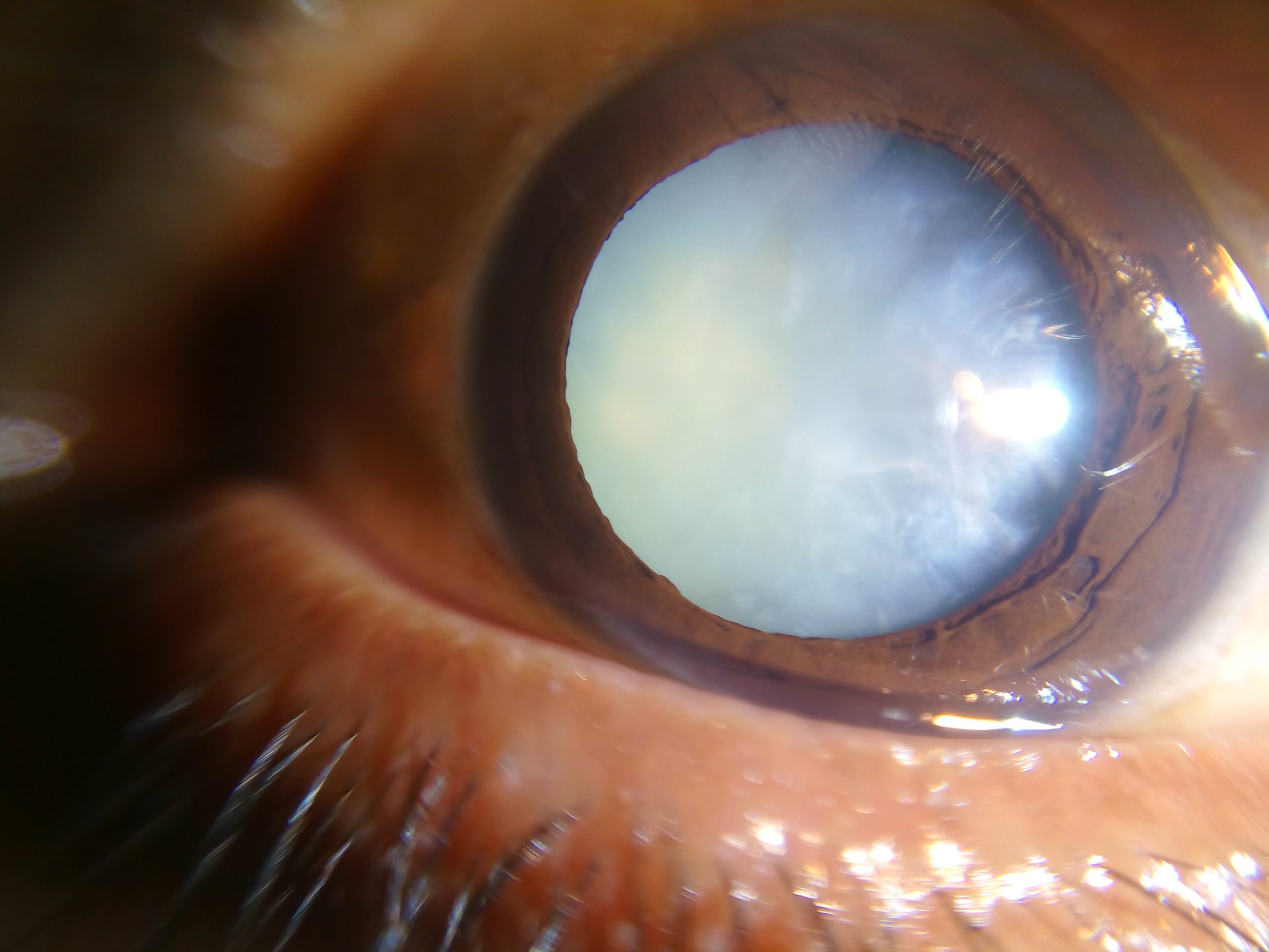 cataracta