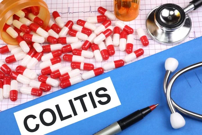 Colitele Colitele