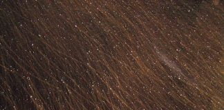 Matreata – cauze si tratament Matreata - cauze si tratament