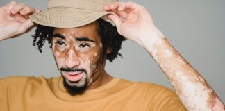 Depigmentarea se realizeaza in functie de dorintele si necesitatile persoanei afectate