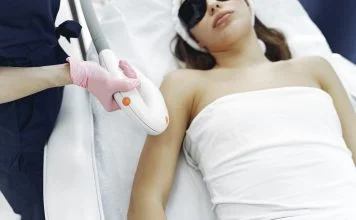 Epilarea