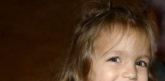 Ce este Sindromul Williams si care sunt simptomele acestuia
