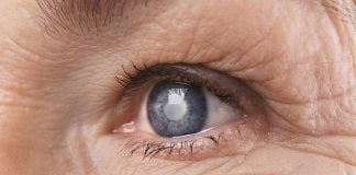 Glaucomul - hotul care fura vederea