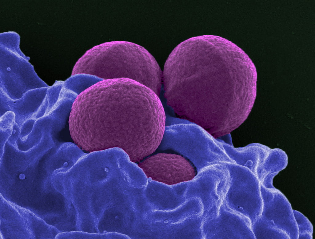 Infectiile stafilococic