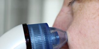 Punctele negre Punctele negre