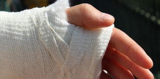 Luxatiile, cauze si tratament