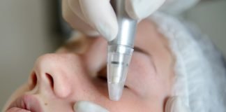 Microdermabraziunea si beneficiile sale Microdermabraziunea si beneficiile sale