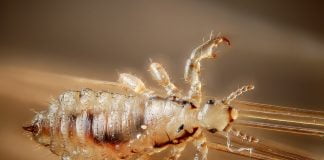 O situatie jenanta - infestarea cu paduchi