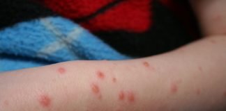 Sifilisul si riscurile lui