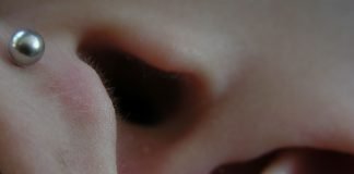 Tinitusul, senzatia de zgomot in ureche