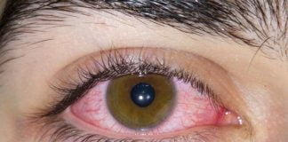 Tulburarile de vedere, o adevarata corvoada