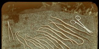 Viermii intestinali si pericolele lor