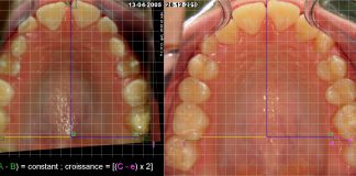 Deglutitie Deglutitie