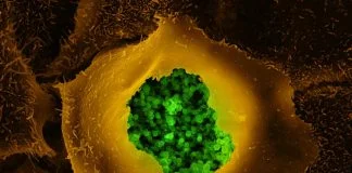 Infectia cu Chlamydia