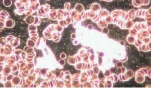 Celule-canceroase-300x175.jpg
