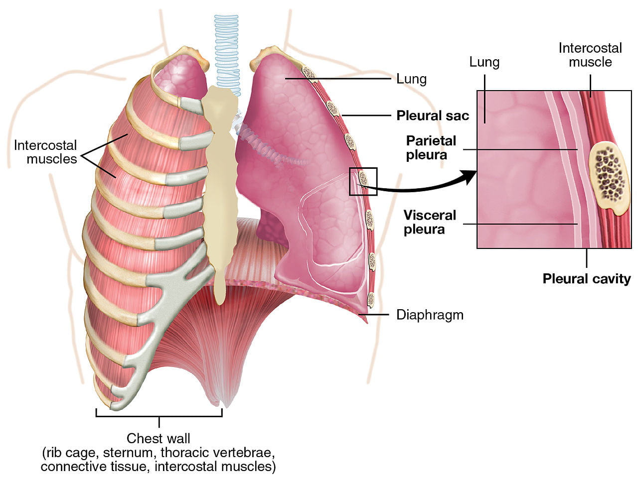 Pleurezia