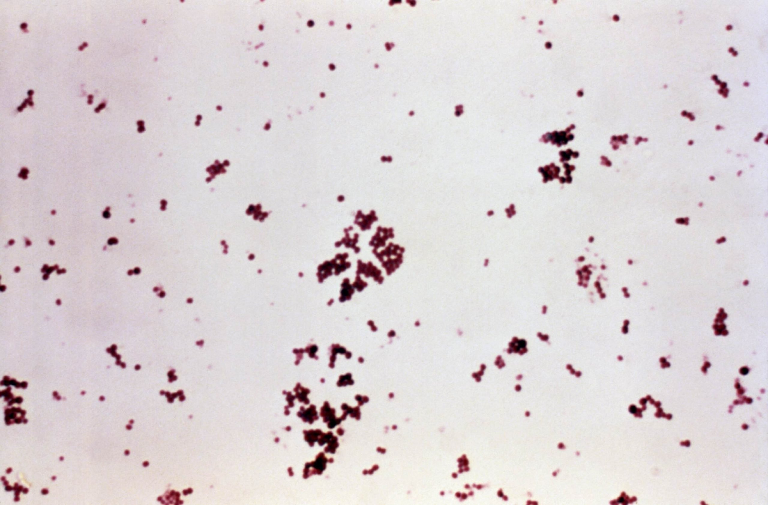 Gram stained micrograph reveals staphylococcus aureus bacteria w