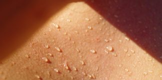Transpiratie excesiva – Cand apare si cum se trateaza? Transpiratie excesiva - Cand apare si cum se trateaza