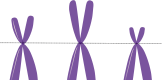 Cromozomii si aberatiile cromozomiale