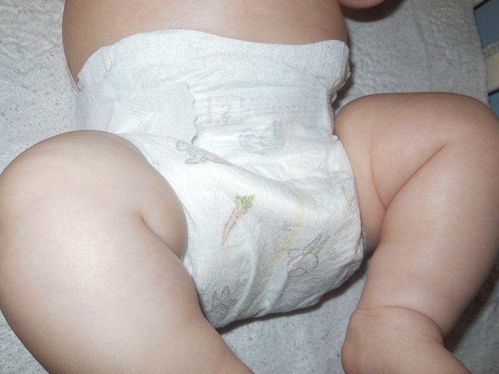 dermatita provocata de scutece