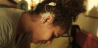 Afazia (disfazia) - tulburare de limbaj