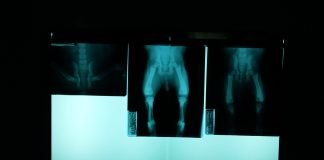 Femei celebre – Cornelia Moga Femei celebre - Cornelia Moga