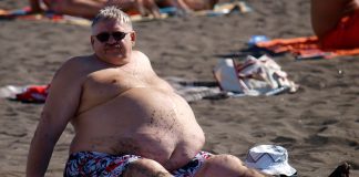 Obezitatea - simptome, cauze, tratament