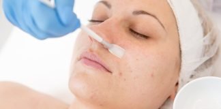 Peeling chimic pentru fata