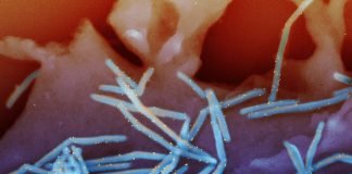 Cum se manifesta si cum se trateaza viroza respiratorie