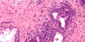 Prostatita sau inflamarea prostatei - Cauze, simptome si tratament