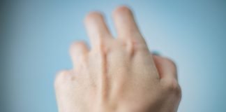 Artrita psoriazica – cauze si tratament Artrita psoriazica - cauze si tratament