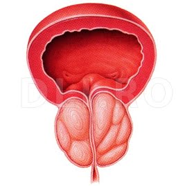 Adenomul de prostată: cauze, simptome, posibile complicații, diagnosticare și tratament