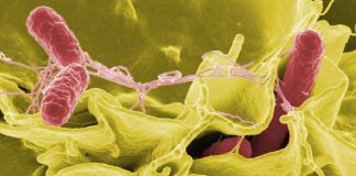 Care sunt simptomele infectiilor cu bacteria Salmonella si cum pot fi prevenite? Care sunt simptomele infectiilor cu bacteria Salmonella si cum pot fi prevenite