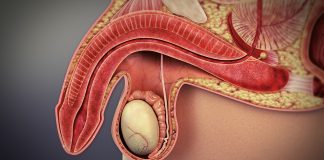 Disfunctia erectila – cauze, simptome, tratament Disfunctia erectila - cauze, simptome, tratament