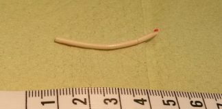 Implantul cu hormoni - o metoda contraceptiva