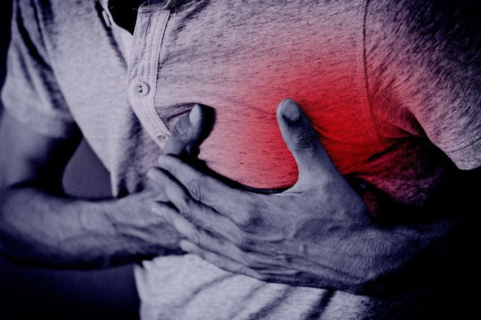 Infarctul miocardic - cauze, simptome si tratament Infarctul miocardic - cauze, simptome si tratament