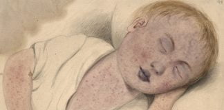 Top 10 cele mai periculoase boli Top 10 cele mai periculoase boli