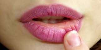Trucuri si sfaturi pentru buze crapate iarna Trucuri si sfaturi pentru buze crapate iarna
