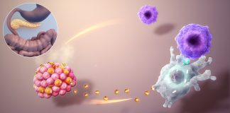 Diabet zaharat de tip 1 (insulino-dependent) Diabet zaharat de tip 1 (insulino-dependent)