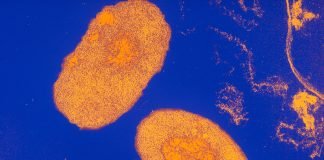 Infectia cu Bordetella pertussis – Tusea convulsiva Infectia cu Bordetella pertussis - Tusea convulsiva