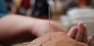 Acupunctura un miracol in caz de accident vascular cerebral Acupunctura un miracol in caz de accident vascular cerebral